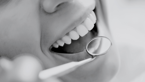 DENSILOX® | The image shows a close-up of smiling teeth. It was taken using a mirror so that a dentist could examine them.