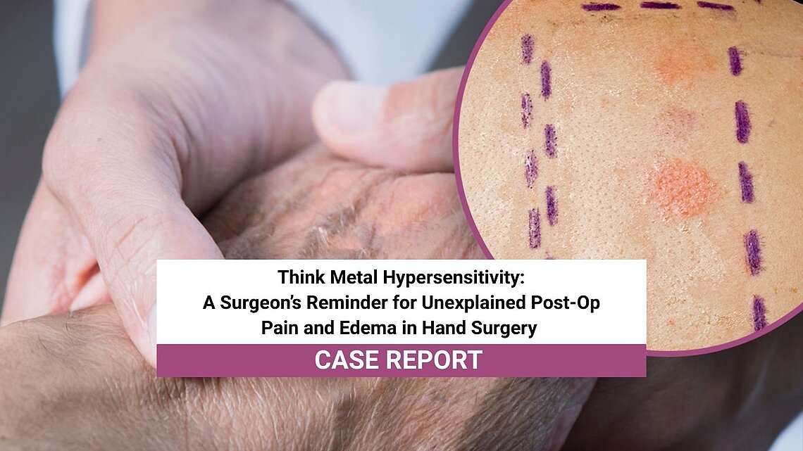 Image showing a clinical wrist examination with a magnified view of a PATCH test, illustrating the evaluation of possible metal hypersensitivity in cases of unexplained postoperative pain and swelling after wrist surgery.