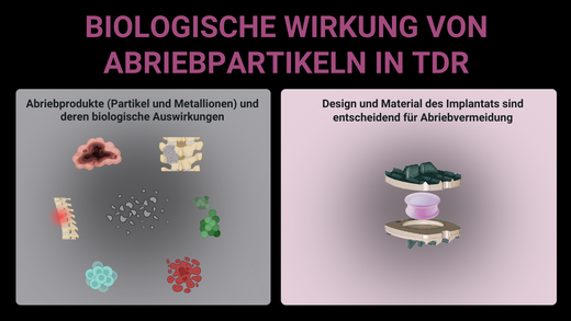 Detaillierte medizinische Illustration zu den biologischen Auswirkungen von Abriebpartikeln und Metallionen in TDR. Die Darstellung ist zweigeteilt: Die linke Seite visualisiert verschiedene Abriebprodukte und deren biologische Reaktionen, während die rechte Seite das Implantatdesign und die Materialauswahl zur Reduktion von Abrieb hervorhebt.