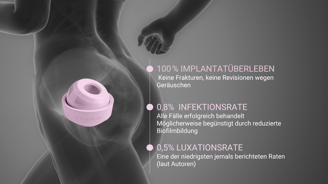 Visualisierung eines BIOLOX® delta CoC Keramik-Hüftimplantats in einem menschlichen Hüftgelenk mit Leistungskennzahlen: 100 % Implantatüberleben, 0,8 % Infektionsrate, 0,5 % Luxationsrate – klinisch validierte Daten zur Implantatsicherheit und -stabilität.