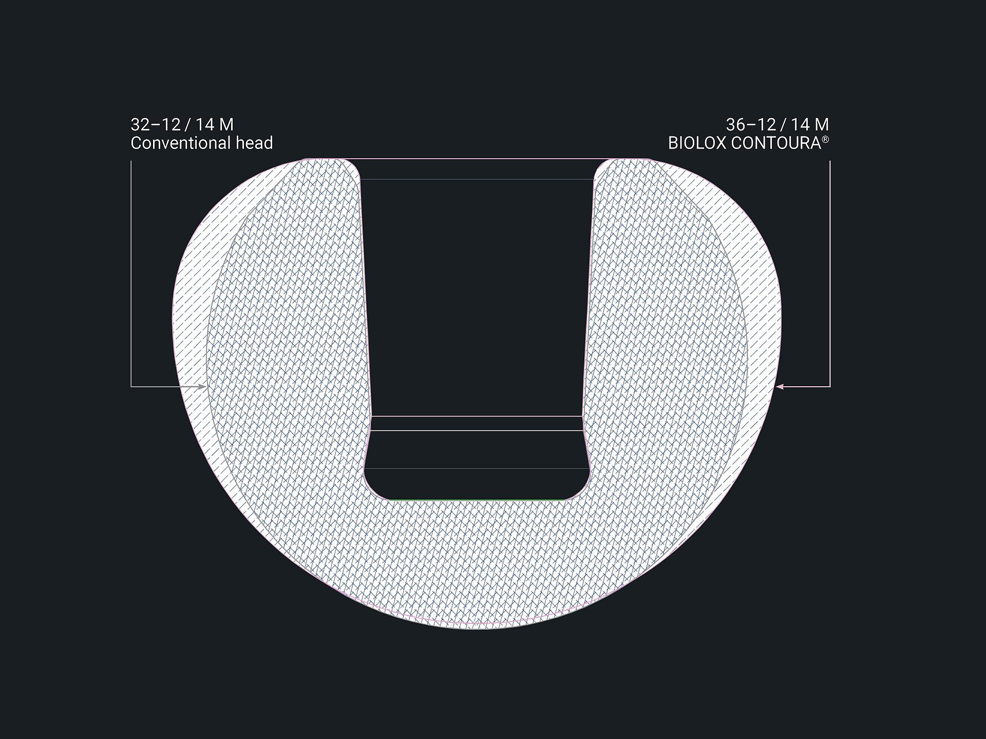 Technical illustration of a BIOLOX CONTOURA® contoured head, highlighting its large diameter and precision-engineered design for orthopedic implants.