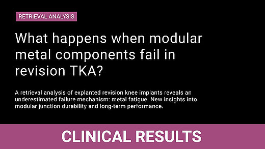 Title picture of retrieval analysis on metal fatigue in revision total knee arthroplasty. 