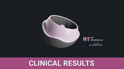3D render of the H1® ceramic-on-ceramic hip resurfacing implant (BIOLOX®delta, Zimmer Biomet) – Clinical Results.