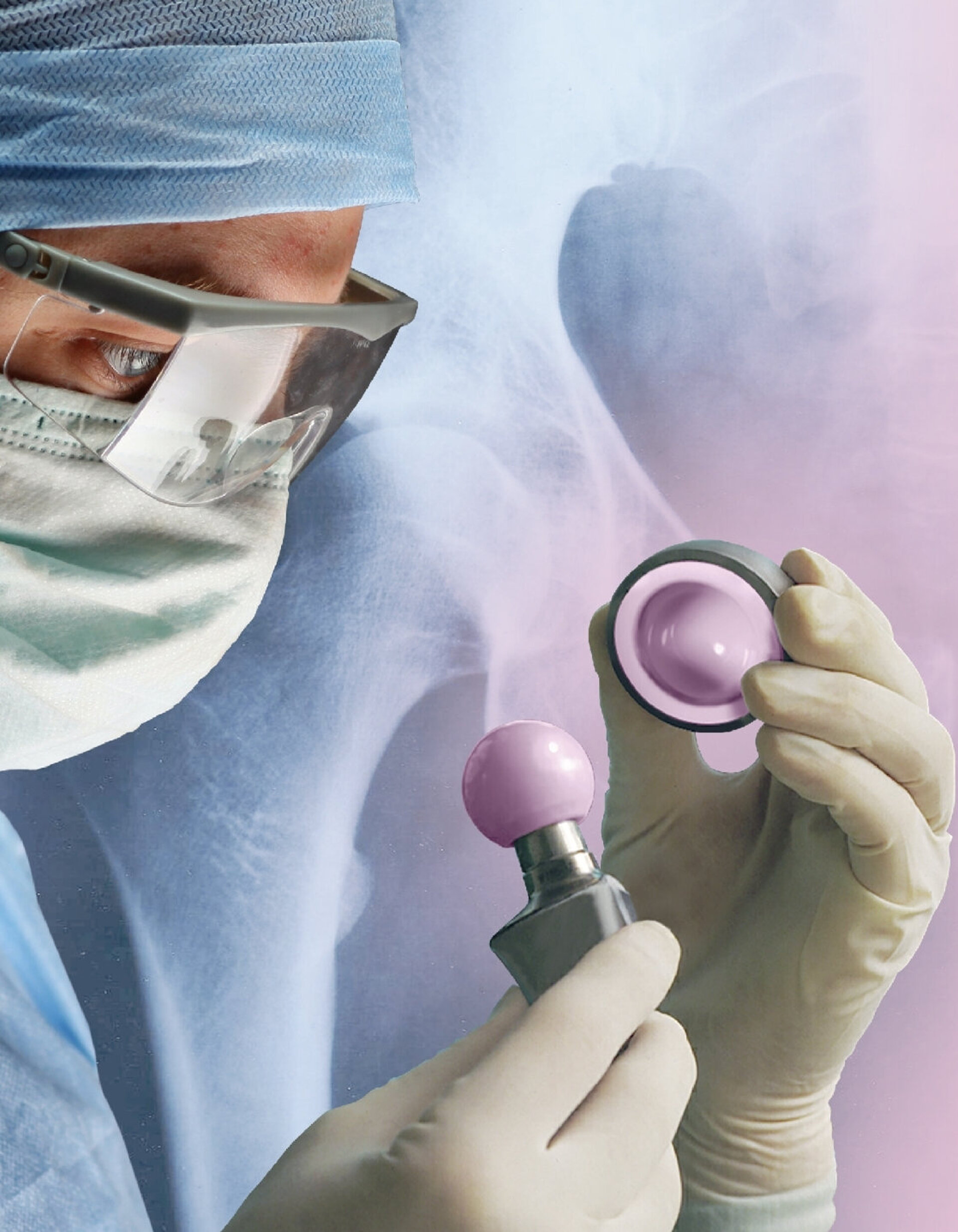 Medical professional in surgical attire holding a pink BIOLOX® ceramic femoral head and insert against a soft blue‑pink background, promoting participation at the SFHG Congress in Nantes and inviting attendees to visit our workshop.