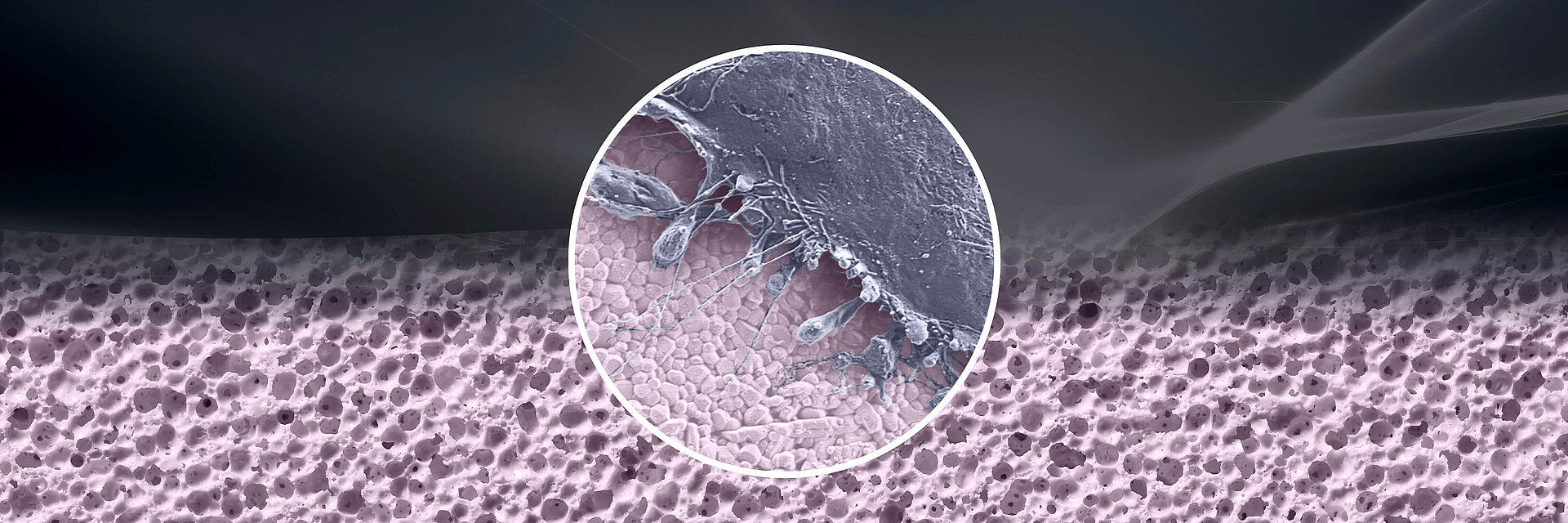 The ceramic particles failed to stimulate an inflammatory response