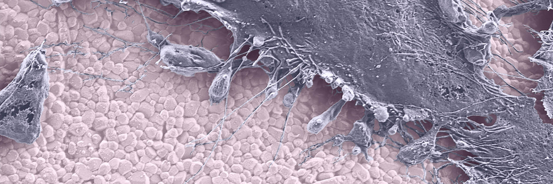 Colourised microscopic view of BIOLOX®delta ceramic hip implant material and cell behaviour on the surface