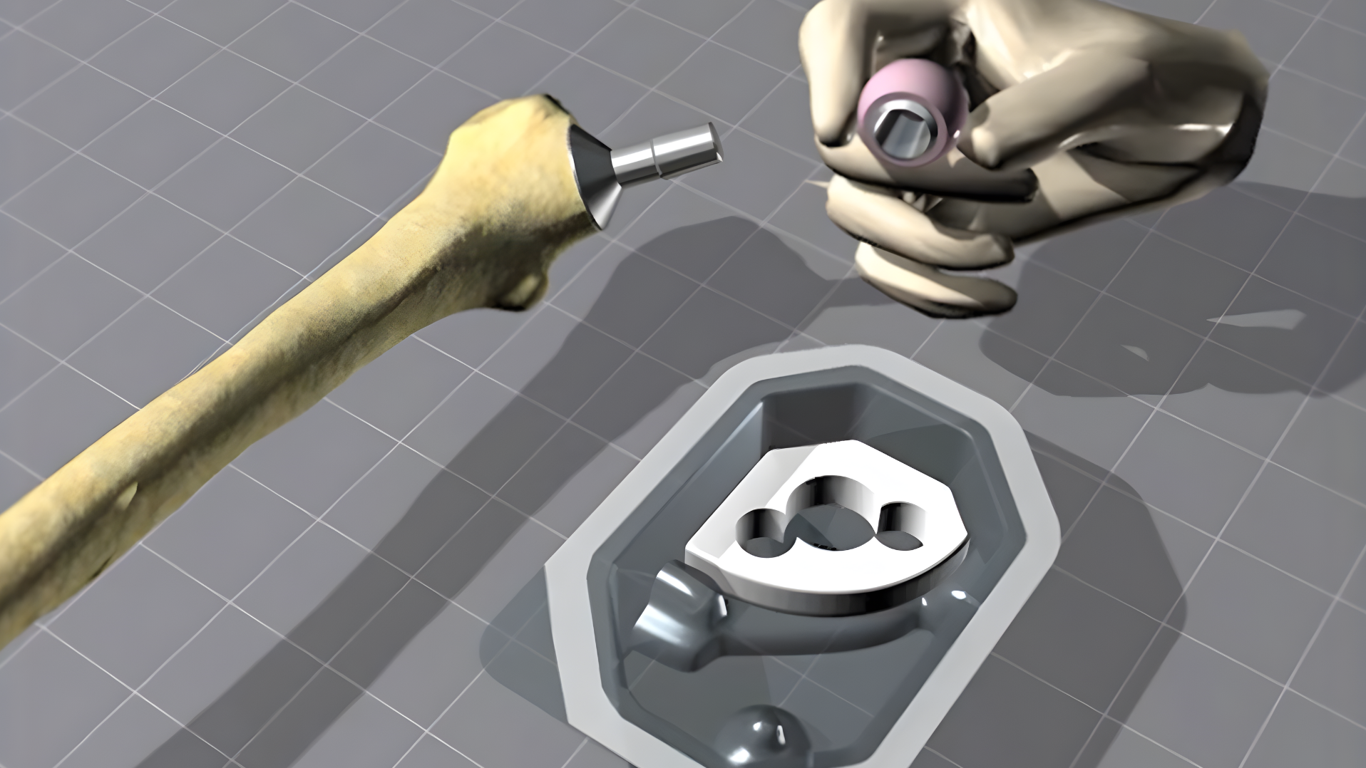 Animamation of how a BIOLOX®OPTION femoral head on a titanium sleeve is assabled