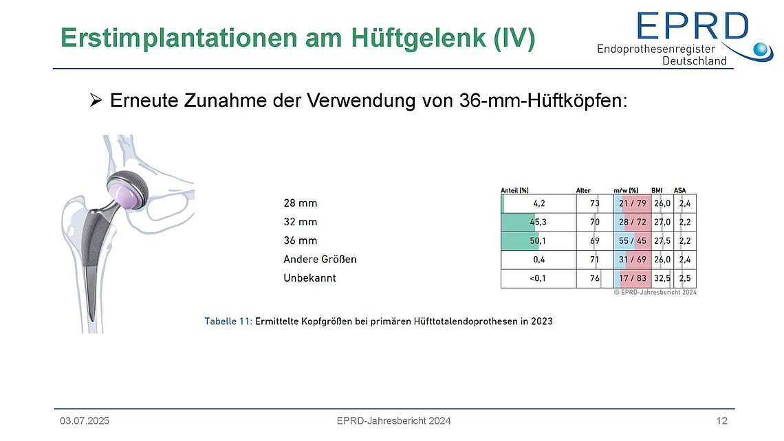 Infografik aus dem EPRD-Jahresbericht 2024 zu Trends bei Hüftkopfgrößen bei Erstimplantationen, mit deutlichem Anstieg der 36-mm-Köpfe. Darstellung eines Hüftimplantats und einer Tabelle zur Kopfgrößen.