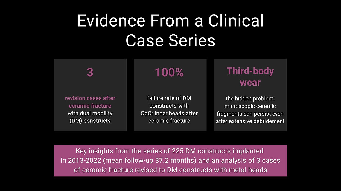 Infographic showing 3 revision cases, 100% DM construct failure rate with CoCr heads, and third-body wear risk after ceramic fracture in THA
