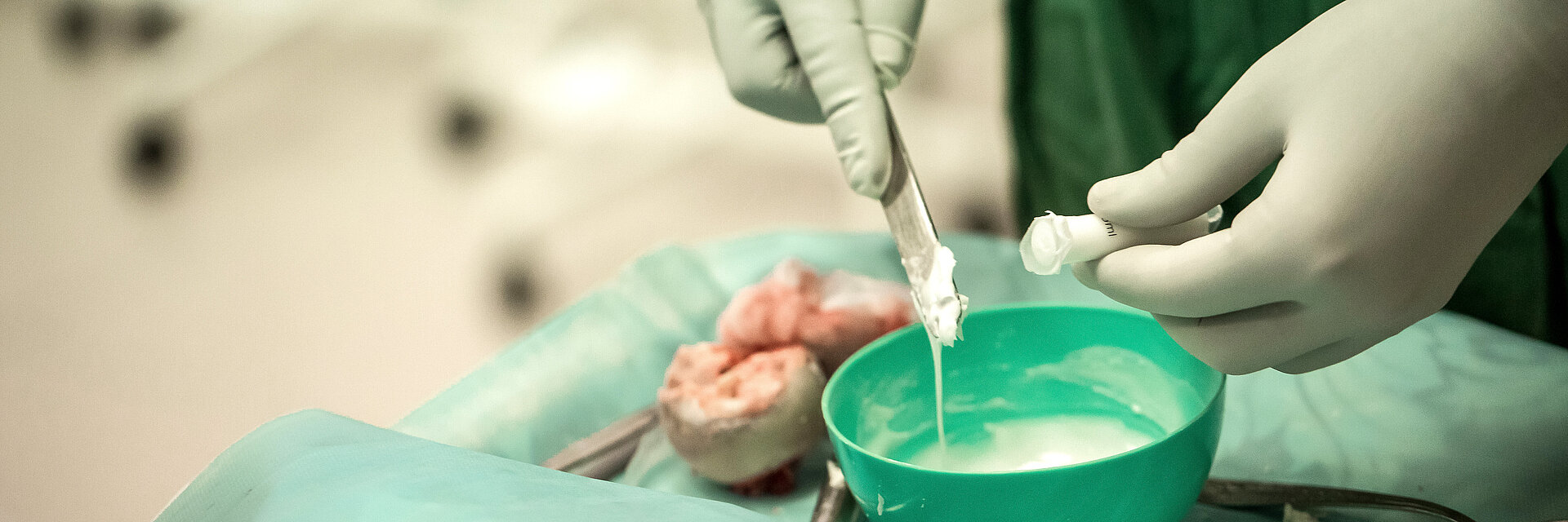 Orthopedic surgeons. Best health care managment in hospital. total hip arthroplasty with cement fixation of components