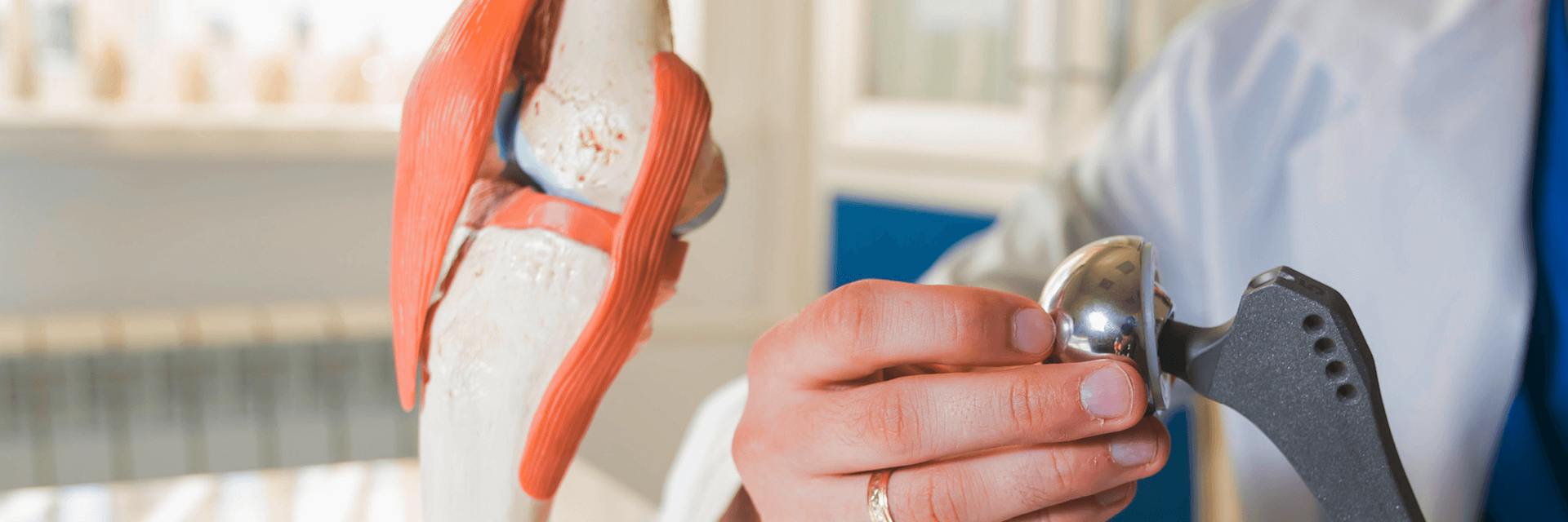 Immunological response of metal containing implants