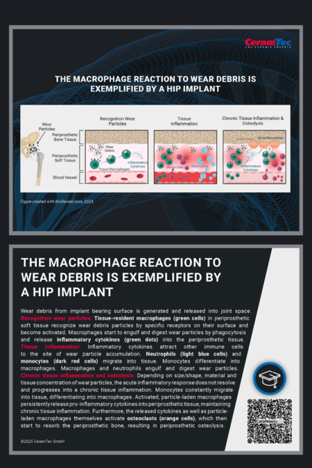 The image titled "The Machrophage Reaction To Wear Debris is Exemplified by a Hip Implant". It is divided into four sections: Wear Particles, Recognition Wear Particles, Tissue Inflammation, and Chronic Tissue Inflammation & Osteolysis.
