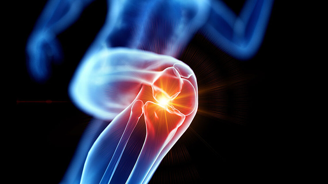 knee joint replacement devices