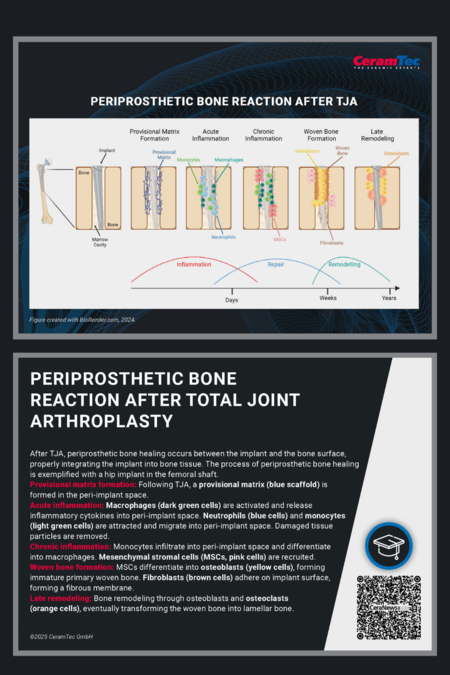 The image titled “Periprosthetic bone reaction after Total Joint Arthroplasty”. It is divided into five sections: Provisional Matrix Formation, Acute Inflammation, Chronic Inflammation, Woven Bone Formation and Late Remodeling.