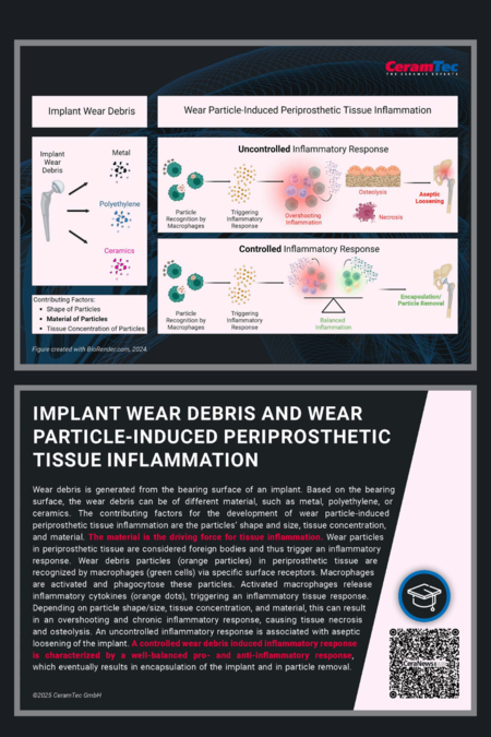 The image titled “Implant Wear Debris and Wear Particle-Induced Periprosthetic Tissue Inflammation”. It is divided into three main sections: Implant Wear Debris, Uncontrolled Inflammatory Response and Controlled Inflammatory Response.