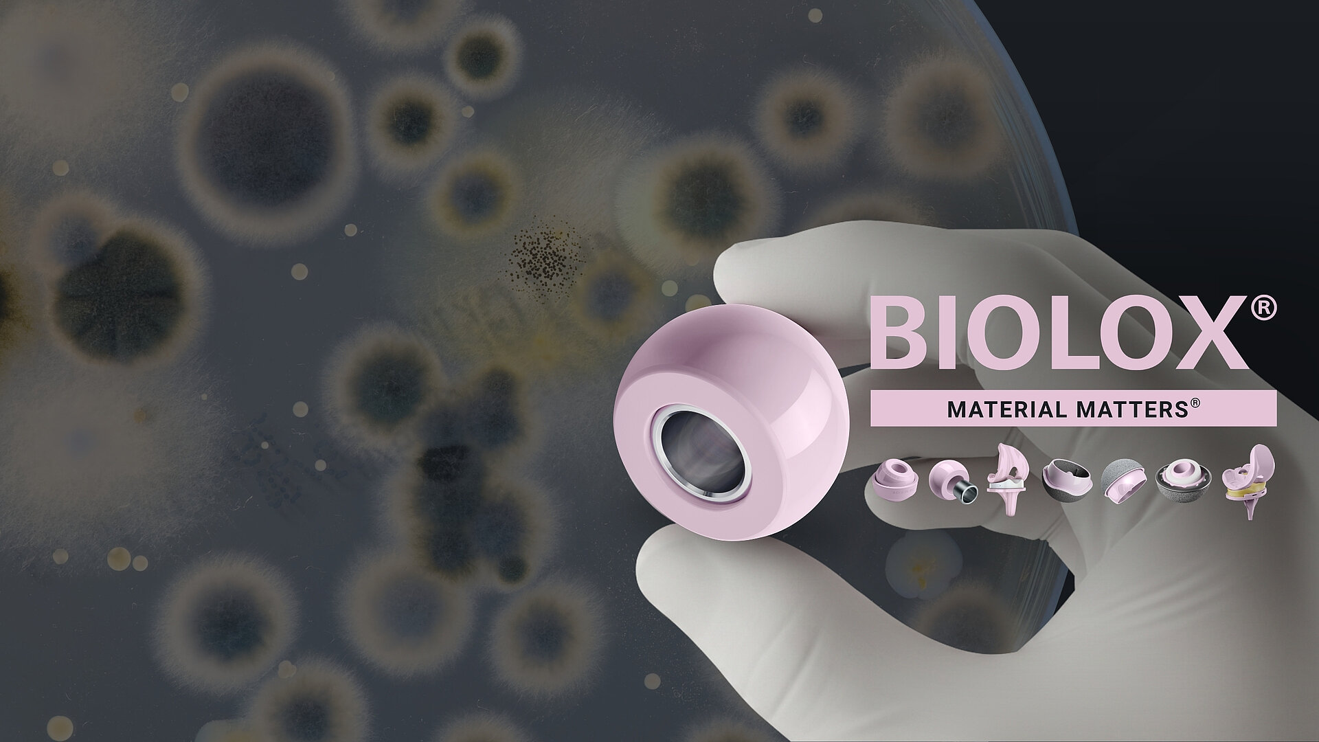Behandschuhte Hand hält einen keramischen BIOLOX®delta-Femurkopf vor einem unscharfen Hintergrund mit Bakterienkulturen.
