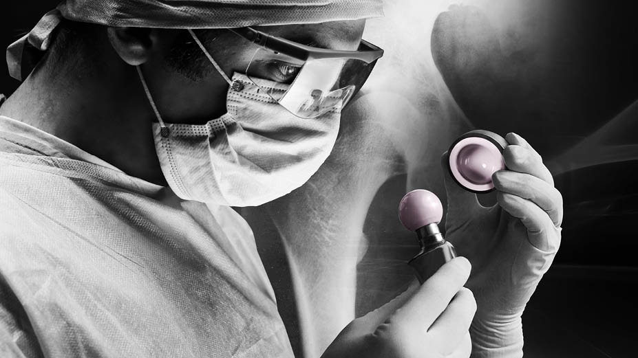 Clinical experience shows no long-term adverse reactions to ceramic particles.