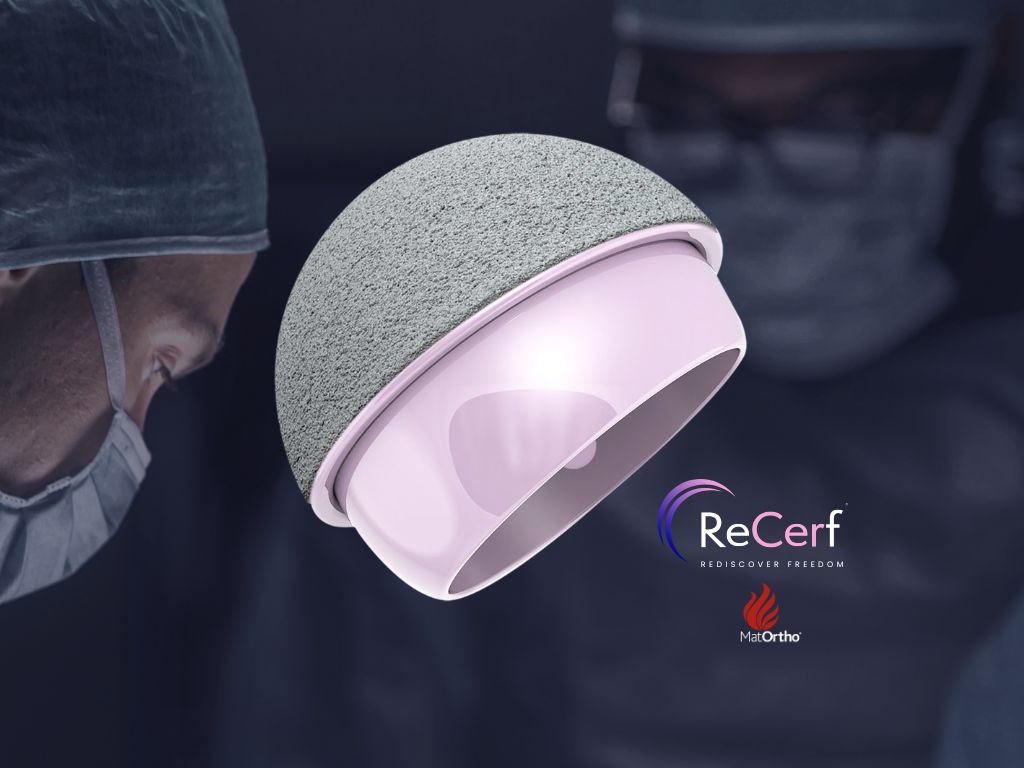 Ceramic hip resurfacing implant with porous grey shell and pink ceramic bearing, ReCerf and MatOrtho logo, surgeons blurred behind
